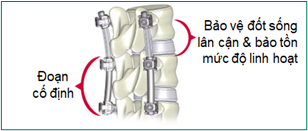 Hình minh họa: Phương pháp cố định lai (Hybrid fusion)