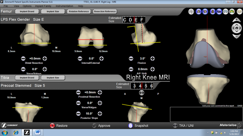 sự hỗ trợ của máy vi tính