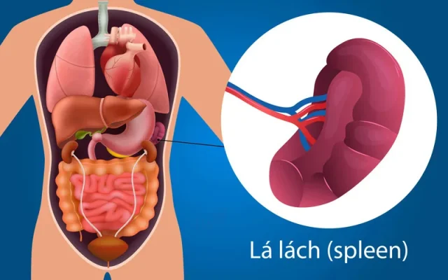 Phẫu thuật cắt lách (Nguồn: Internet)