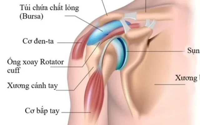 Phẫu thuật điều trị dây chằng khớp vai (Nguồn: Internet)