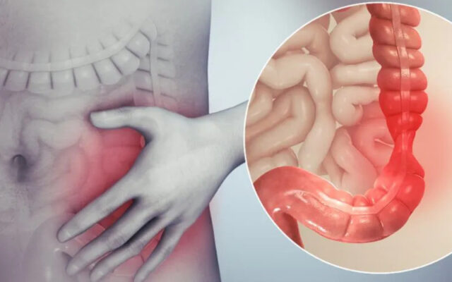 Tìm hiểu về rửa ruột (Nguồn: Internet)
