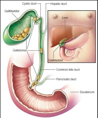 Hình ảnh minh họa túi mật (Nguồn: Internet)