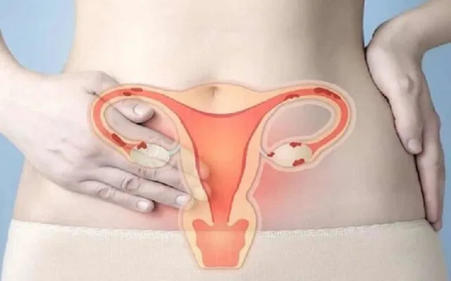 Ung thư cổ tử cung (Nguồn: Internet)