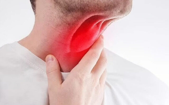 Ung thư vòm họng (Nguồn: Internet)