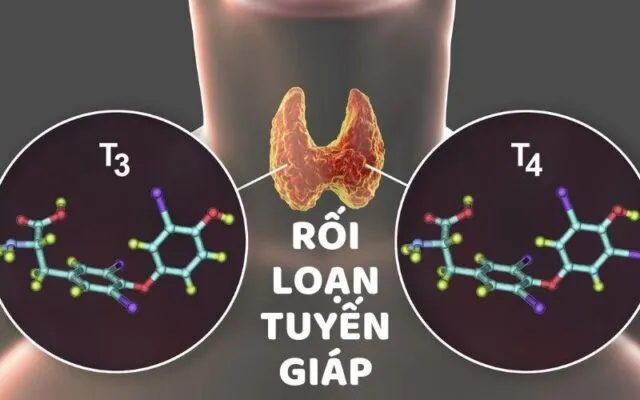 Rối loạn tuyến giáp (Nguồn: Internet)