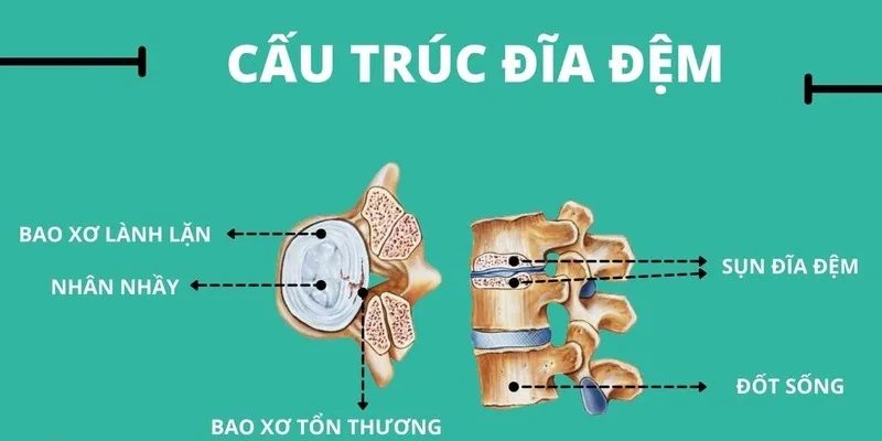 Cấu trúc đĩa đệm (Nguồn: Internet)