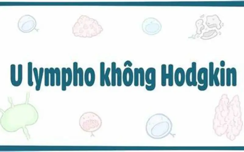 Tìm hiểu về u lympho không hodgkin (Nguồn: Internet)