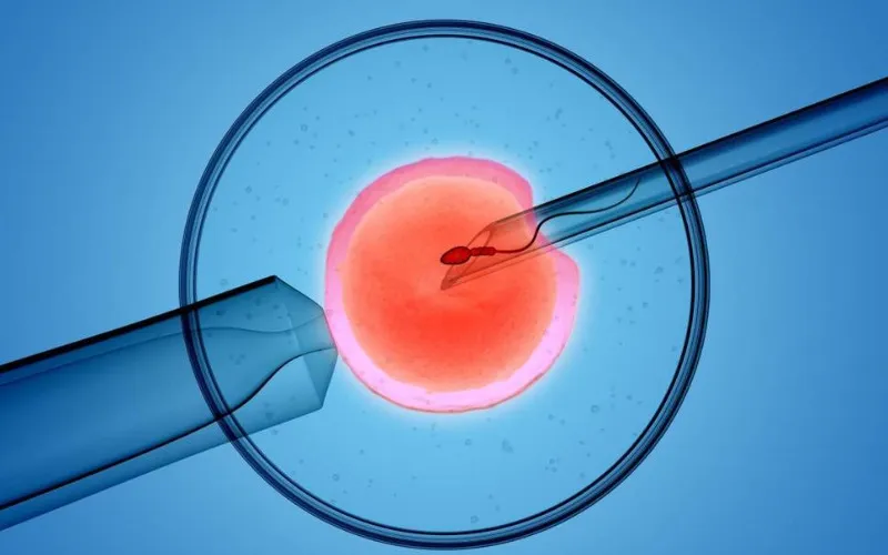 Thụ tinh trong ống nghiệm (IVF) (Nguồn: Internet)