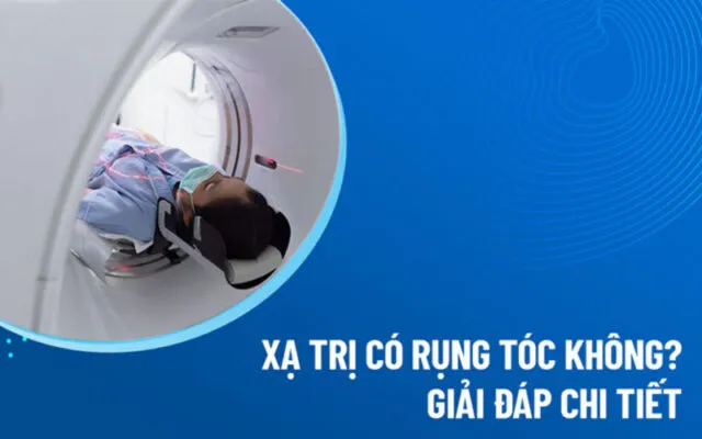 Xạ trị có rụng tóc không? (Nguồn: Internet)