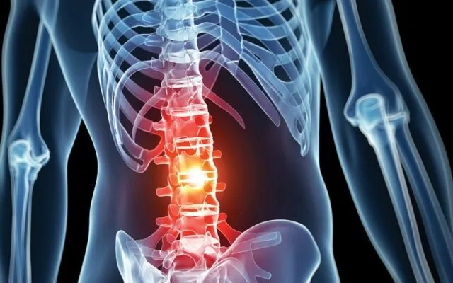 Thoái hóa cột sống (Nguồn: Internet)