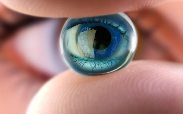 Đục thủy tinh thể (Nguồn: Internet)