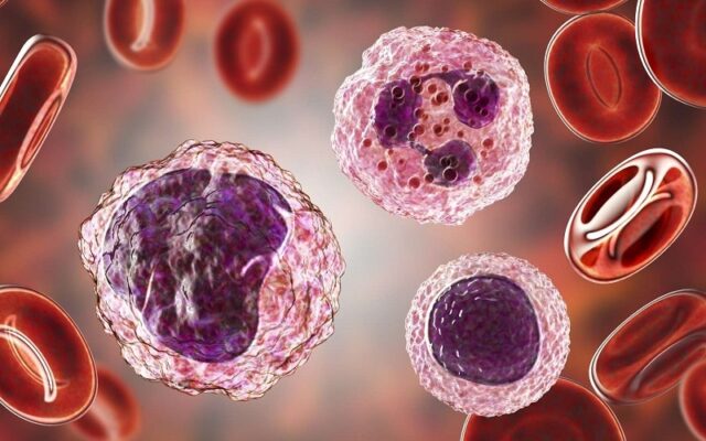 Tình trạng lympho tăng (Nguồn: Internet)