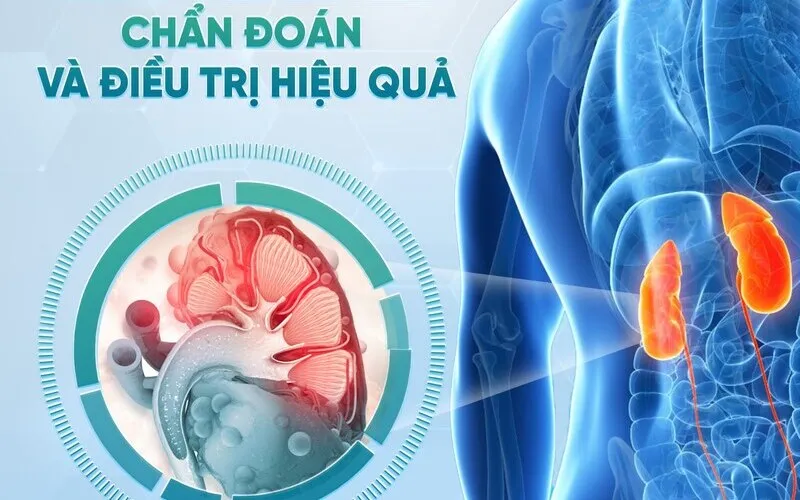 Chẩn đoán và điều trị nang thận hiệu quả (Nguồn: Raffles Hospital)