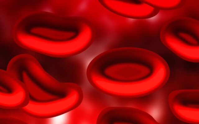 Thiếu máu (Nguồn: Internet)