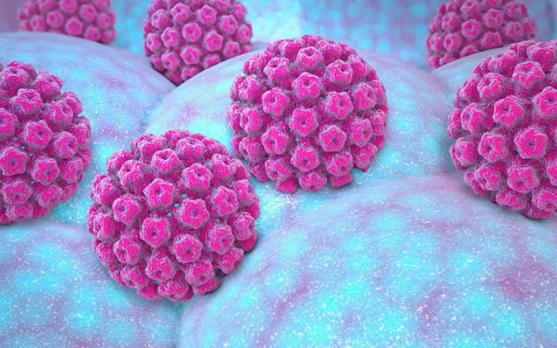 Nhiễm virus HPV (Nguồn: Internet)