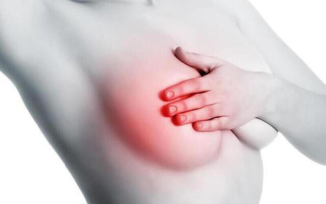 Triệu chứng của ung thư vú dạng viêm (Nguồn: Internet)