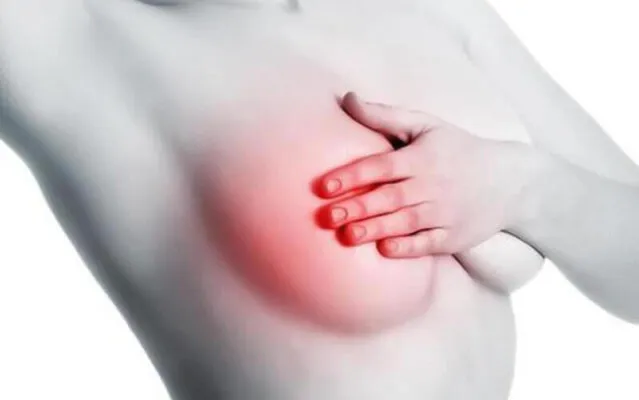 Triệu chứng của ung thư vú dạng viêm (Nguồn: Internet)