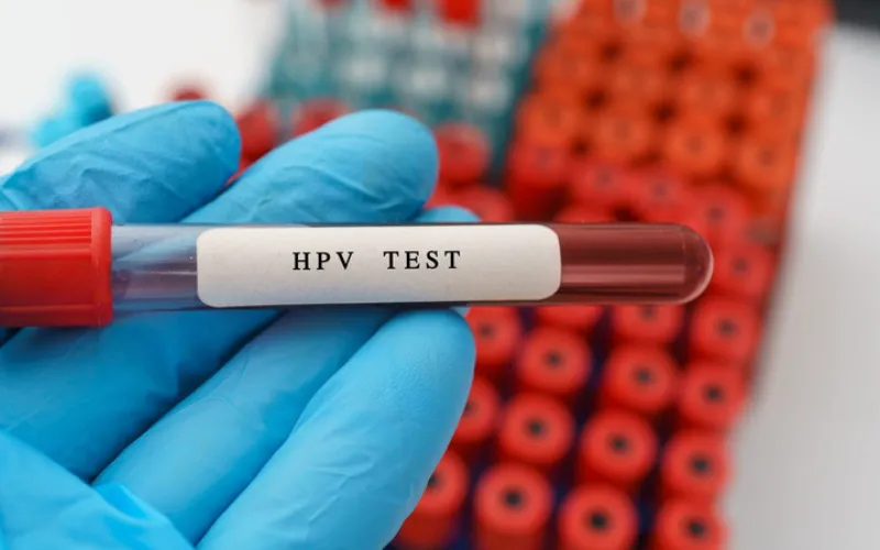 Xét nghiệm ung thư cổ tử cung HPV DNA (Nguồn: Internet)