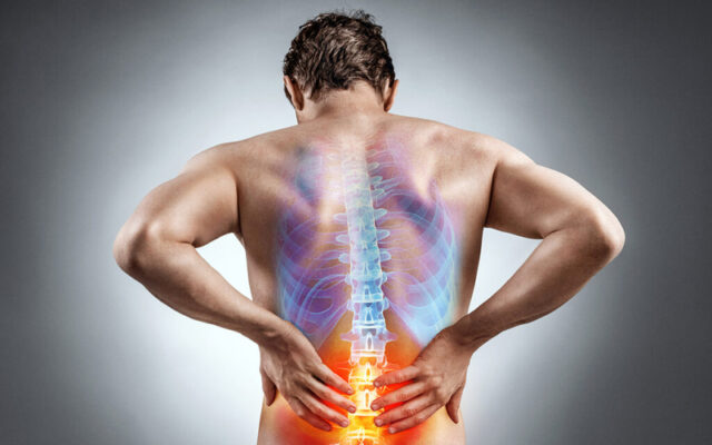 Thoát vị đĩa đệm (Nguồn: Internet)