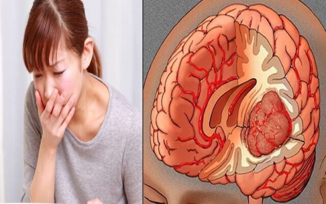 U não (Nguồn: Internet)