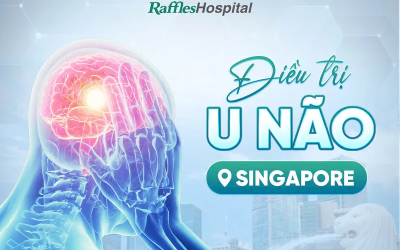 Điều trị u não hiệu quả cùng Raffles Hospital (Nguồn: Raffles Hospital)