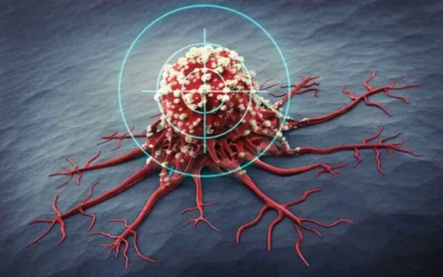 Điều trị ung thư để kiểm soát bệnh và kéo dài thời gian sống (Nguồn: Internet)