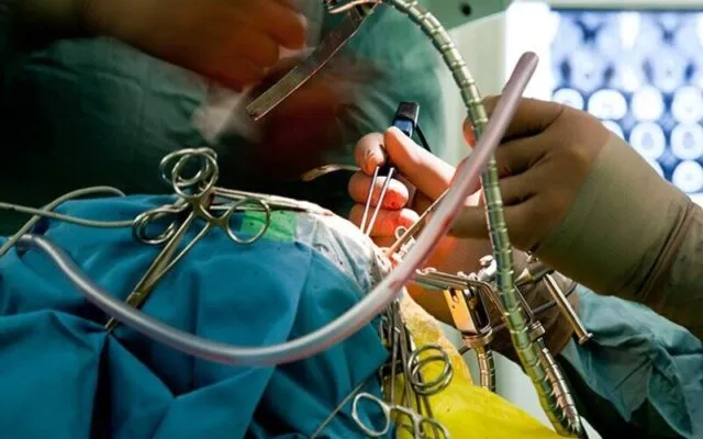 Phẫu thuật dị dạng mạch máu não (Nguồn: Internet)