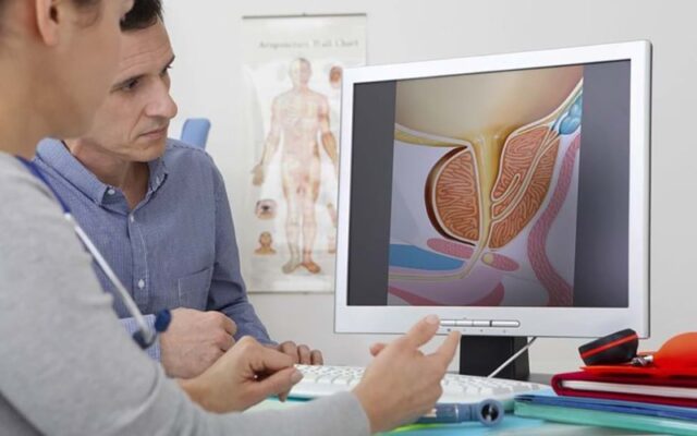 Tầm soát ung thư tiền liệt tuyến (Nguồn: Internet)