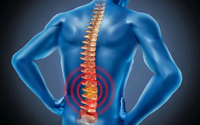 Thoái hóa cột sống m47 (Nguồn: Internet)