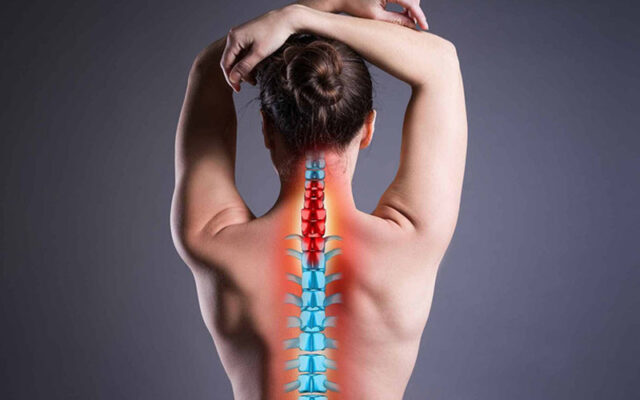 Thoát vị đĩa đệm cột sống cổ (Nguồn: Internet)