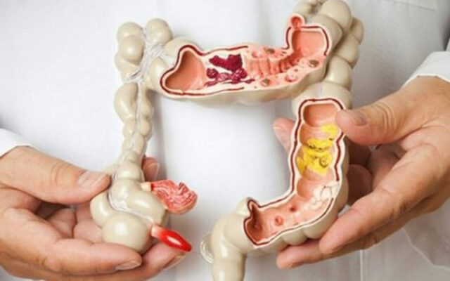 Tại sao nên chọn bệnh viện điều trị ung thư đại tràng tốt nhất TP.HCM (Nguồn: Internet)