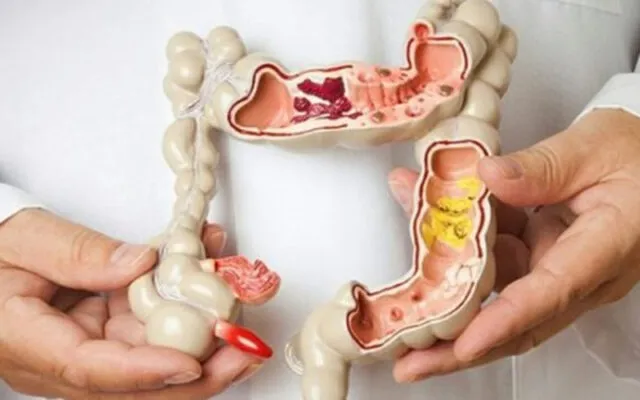 Tại sao nên chọn bệnh viện điều trị ung thư đại tràng tốt nhất TP.HCM (Nguồn: Internet)