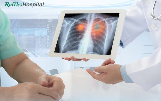Raffles Hospital - Bệnh viện điều trị ung thư phổi tốt nhất Hà Nội (Nguồn: Raffles Hospital)