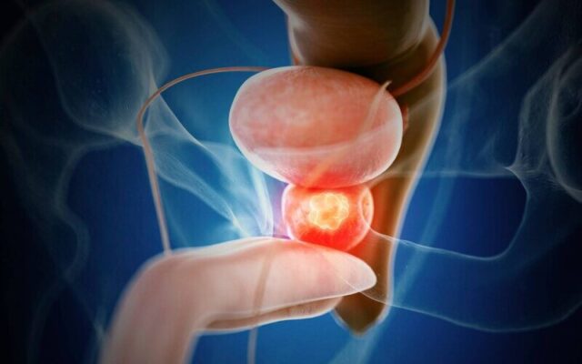 Chọn bệnh viện điều trị ung thư tuyến tiền liệt tốt nhất Hà Nội để được trải nghiệm dịch vụ khám chữa bệnh tốt (Nguồn: Internet)