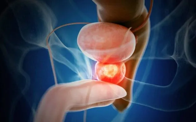 Chọn bệnh viện điều trị ung thư tuyến tiền liệt tốt nhất Hà Nội để được trải nghiệm dịch vụ khám chữa bệnh tốt (Nguồn: Internet)