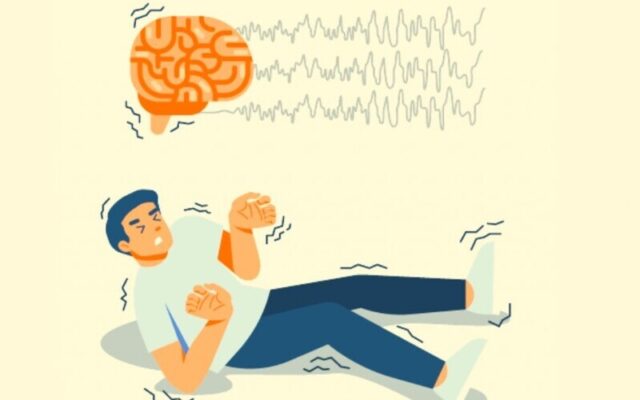 Động kinh (Nguồn: Internet)