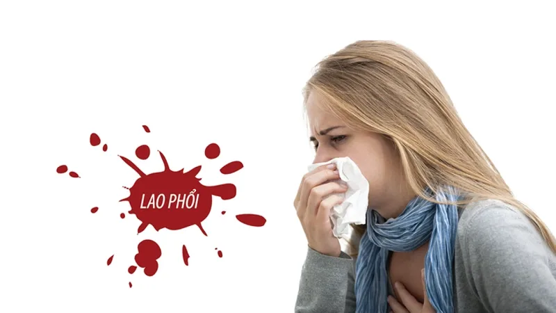 Bệnh lao phổi có lây không (Nguồn: Internet)