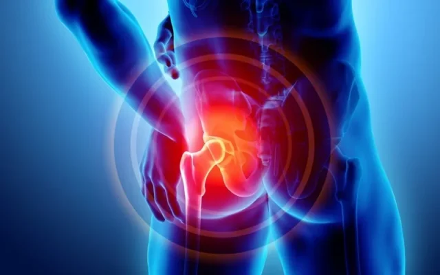 Đau khớp háng (Nguồn: Internet)