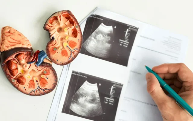 Chẩn đoán suy thận (Nguồn: Internet)