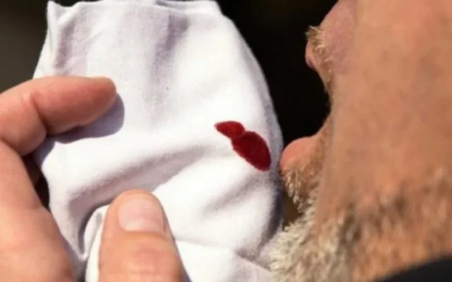 Vì sao khạc đờm ra máu xảy ra? (Nguồn: Internet)