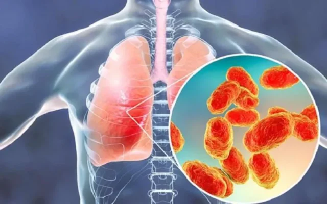 Viêm phổi có thể tự khỏi không? (Nguồn: Internet)