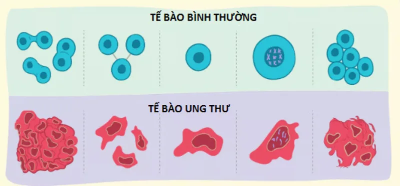 Tế bào ung thư (Nguồn: Internet)