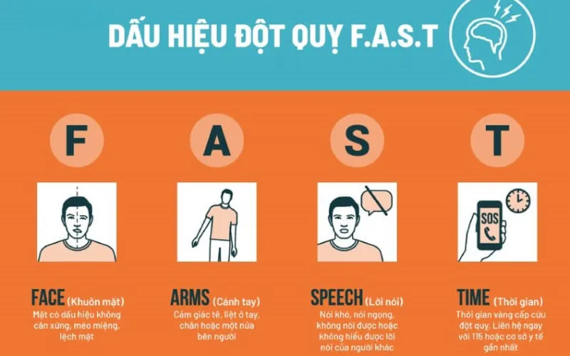 Dấu hiệu nhận biết đột quỵ (FAST) (Nguồn: Internet)