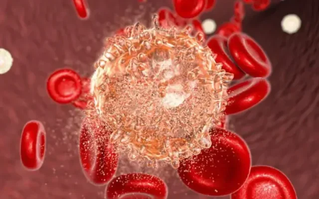 Giai đoạn ung thư máu ảnh hưởng đến điều trị và tiên lượng như thế nào? (Nguồn: Internet)