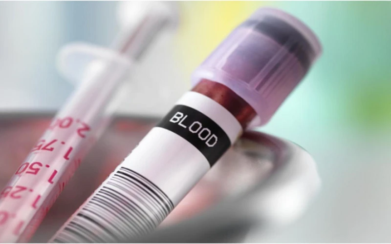 Lợi ích khi chọn bệnh viện tầm soát ung thư máu tốt nhất TPHCM (Nguồn: Internet)