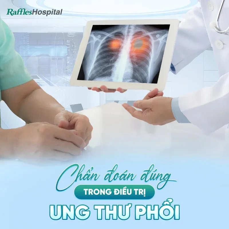 Raffles Hospital - Top 7 bệnh viện tầm soát ung thư phổi tốt nhất TPHCM (Nguồn: Raffles Hospital)