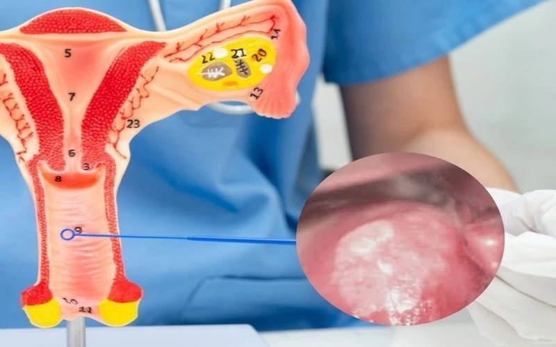 vet trang co tu cung co sao khong 1